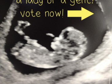 UltrasoundVote